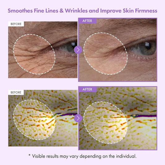 TOSOWOONG Bakuchiol Capsule Cream, High Purity Bakuchiol 5,000ppm, Retinol Alternative Wrinkle Care, Firming Anti Aging Moisturizer, 12 Peptides, 3 Ceramides, Korean Skincare, 50ml / 1.69 fl. oz.