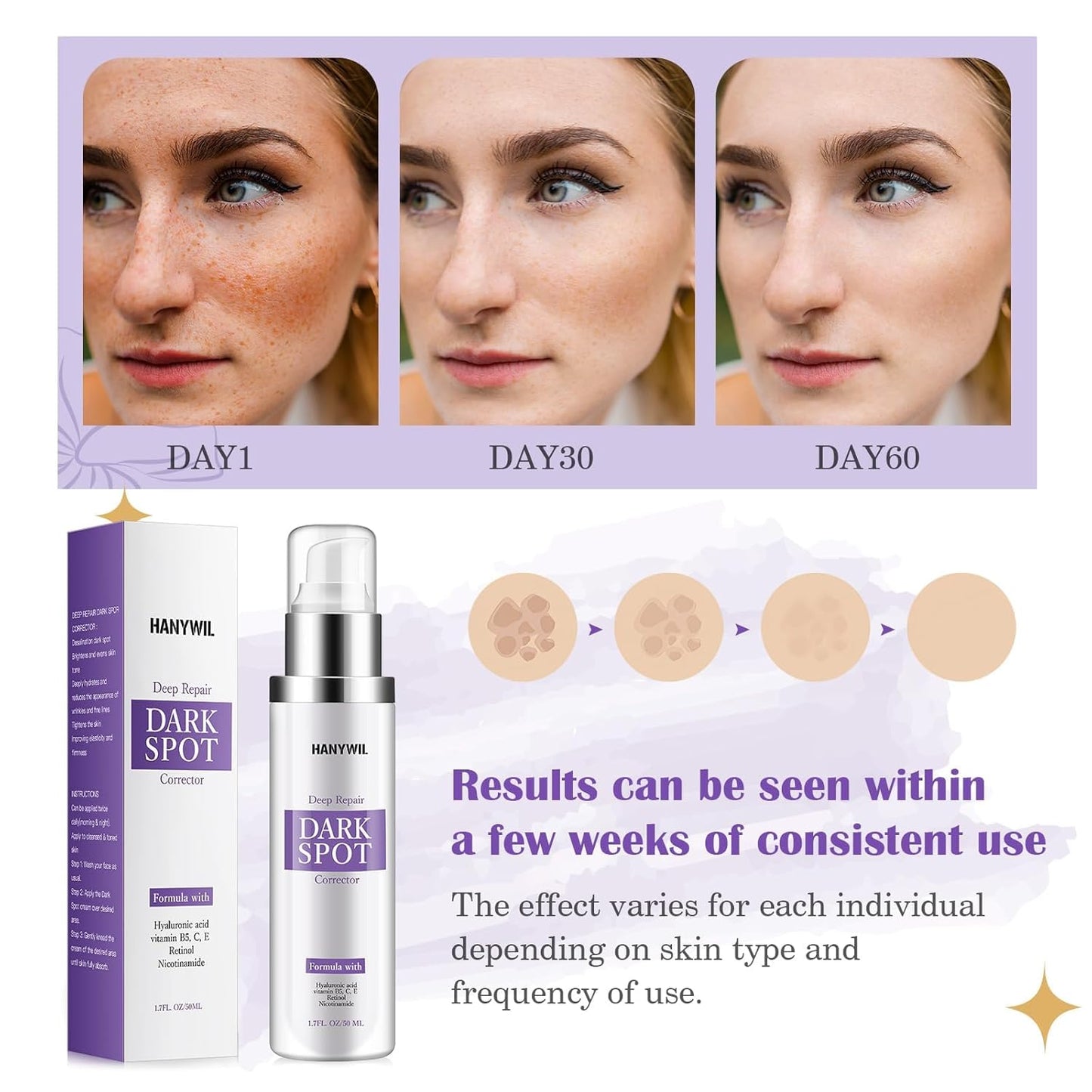 HANYWIL Dark Spot Remover for Face & Body Serum with Retinol & Niacinamide - Corrects Melasma, Sun & Age Spots, Hyperpigmentation Treatment for All Skin, Dermatologist Tested (1.7 Fl Oz)